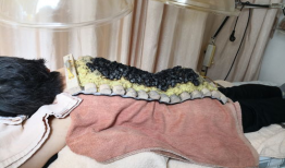 火龙灸操作视频